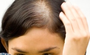 Come contrastare la perdita di capelli nelle donne